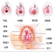 处女膜修复需要多少钱
